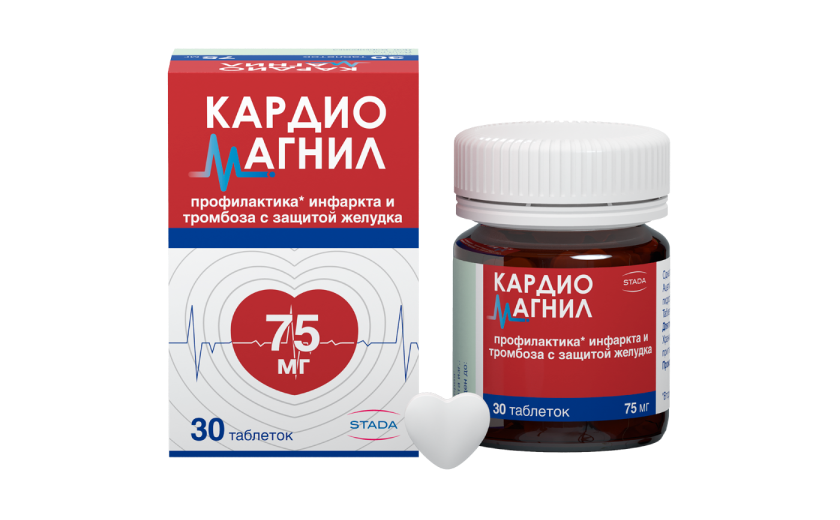 კარდიომაგნილი