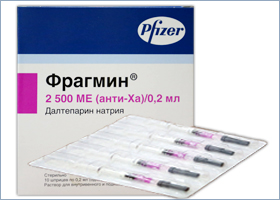 ფრაგმინი
